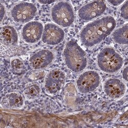 FBXW2 Antibody, Novus Biologicals 25 &mu;L, Unlabeled:Antibodies, Polyclonal